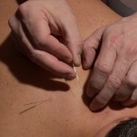 Akupunktur hilft bei Erkähltung, Huste, Schleim, Schmerzen